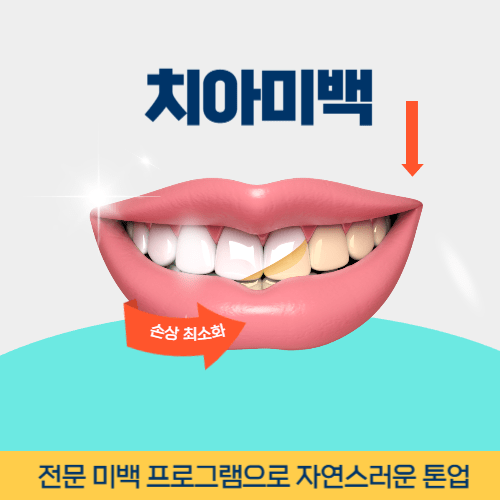 영주치과 영주시 치과 치아미백